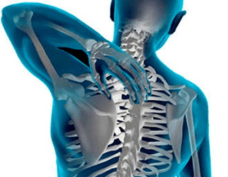 Manifestazioni di osteocondosi della colonna vertebrale toracica